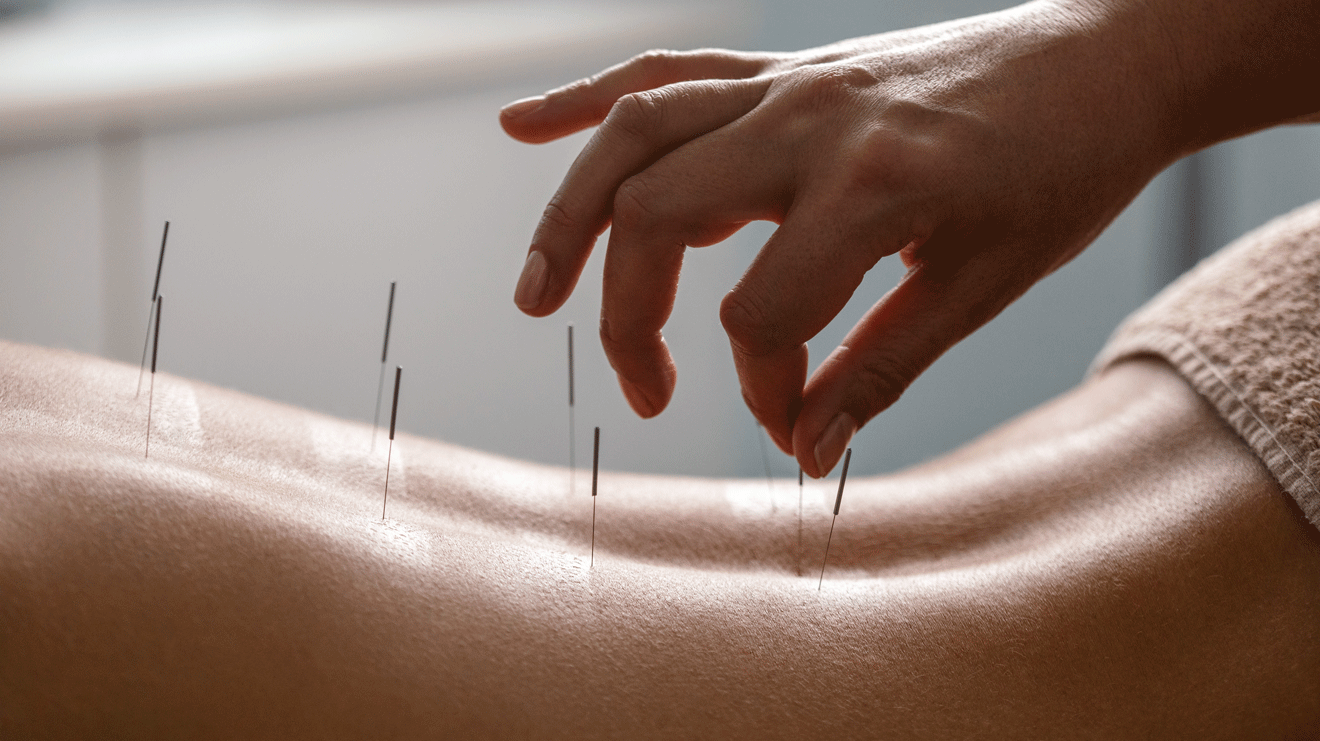 Akupunktur ist, vereinfacht ausgedrückt, eine Regulationstherapie, die eine ganzheitliche Behandlung ermöglicht und nicht nur den Befund, sondern auch das Befinden miteinbezieht.  - 