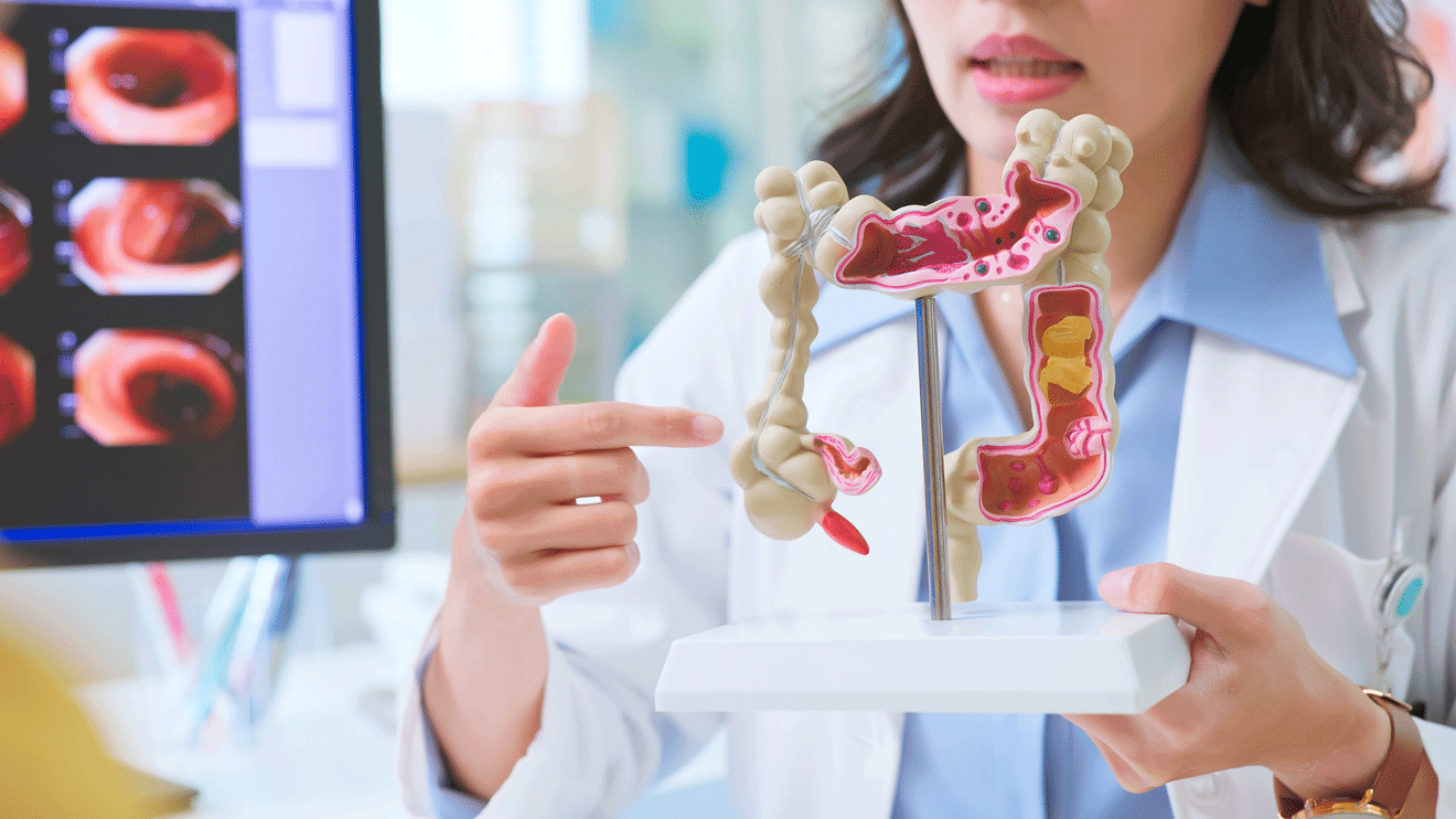 Die Darmkrebsvorsorge ist keine lästige Pflicht, sondern eine der effektivsten Maßnahmen zum Schutz Ihrer Gesundheit. - istock/PonyWang