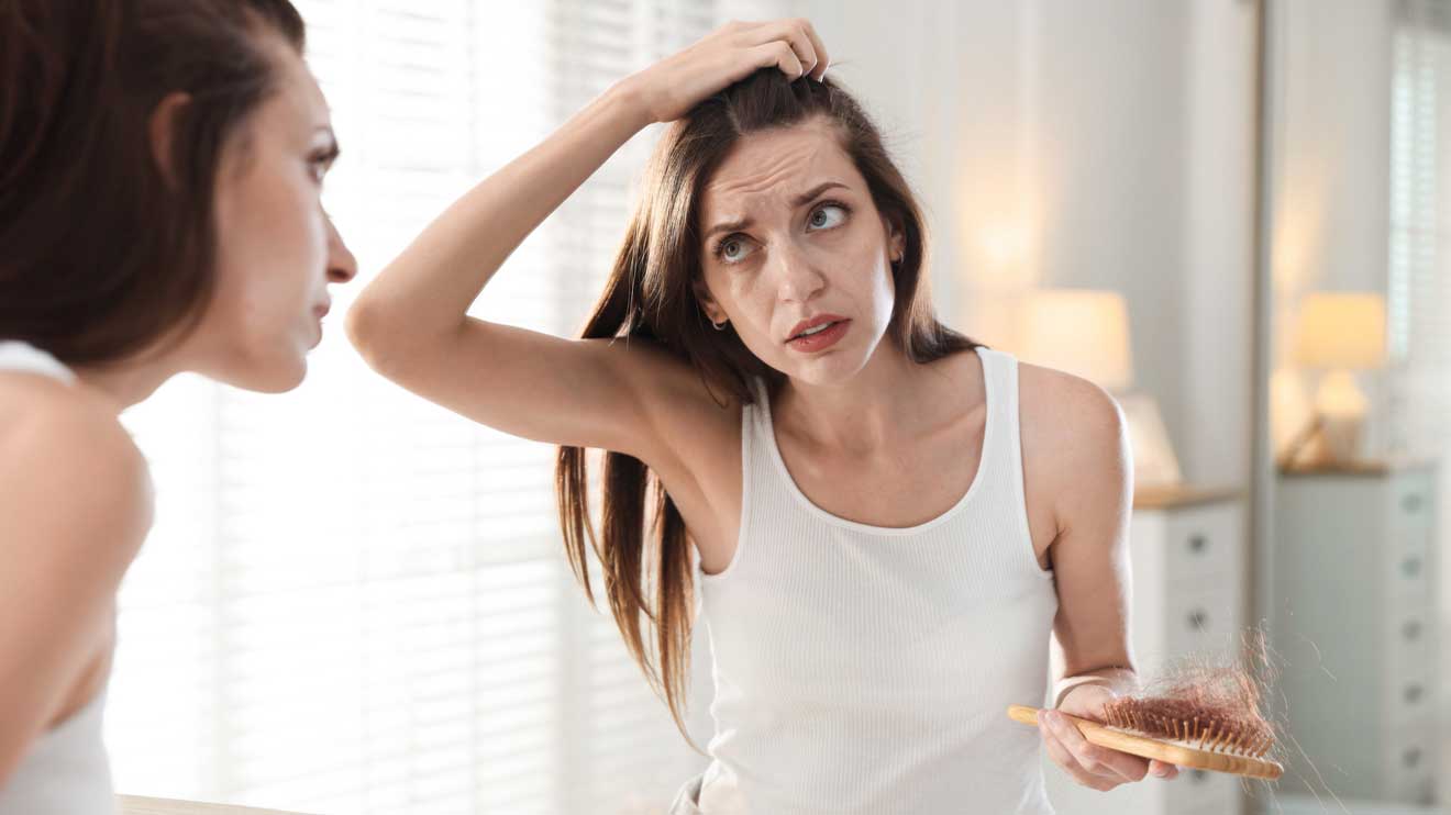 Androgenetischer Haarausfall zeigt sich bei Frauen häufig am Scheitel: Der Scheitel wird breiter, das Haar am Oberkopf wirkt lichter, einzelne Haare werden feiner.  - iStock/Olga Yastremska 