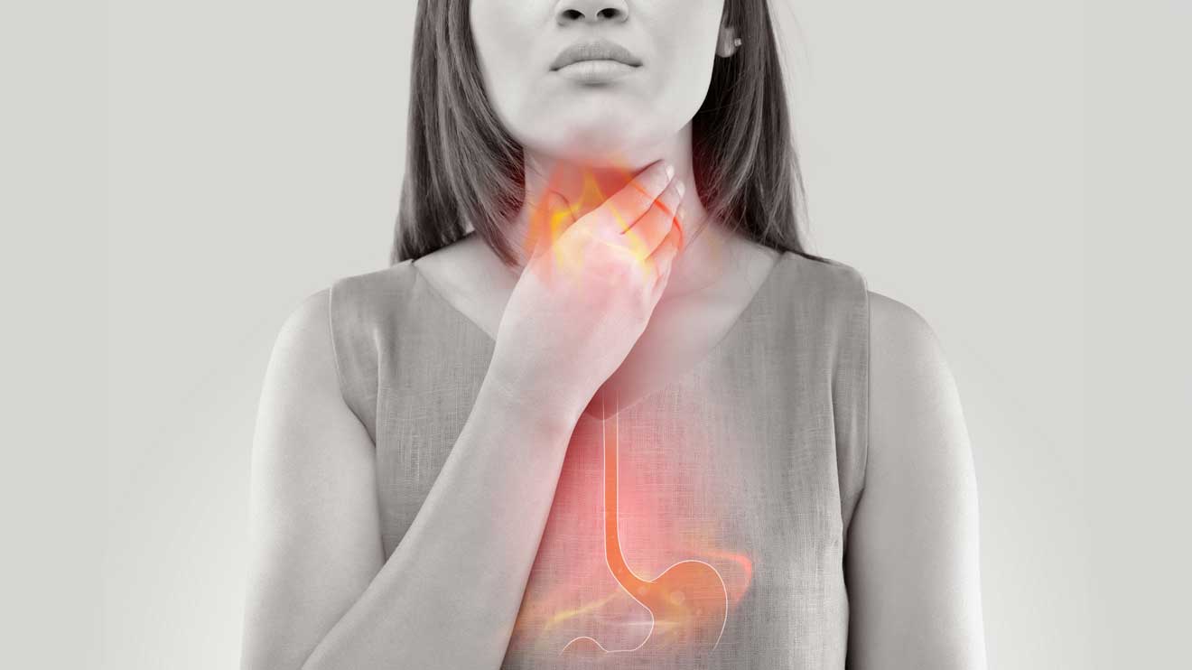 Auch untypische Symptome wie Reizhusten, Heiserkeit, Räuspern oder Halsschmerzen können auftreten, wenn Magensäure die Atemwege reizt oder gasförmige Bestandteile aufsteigen. - iStock/Tharakorn